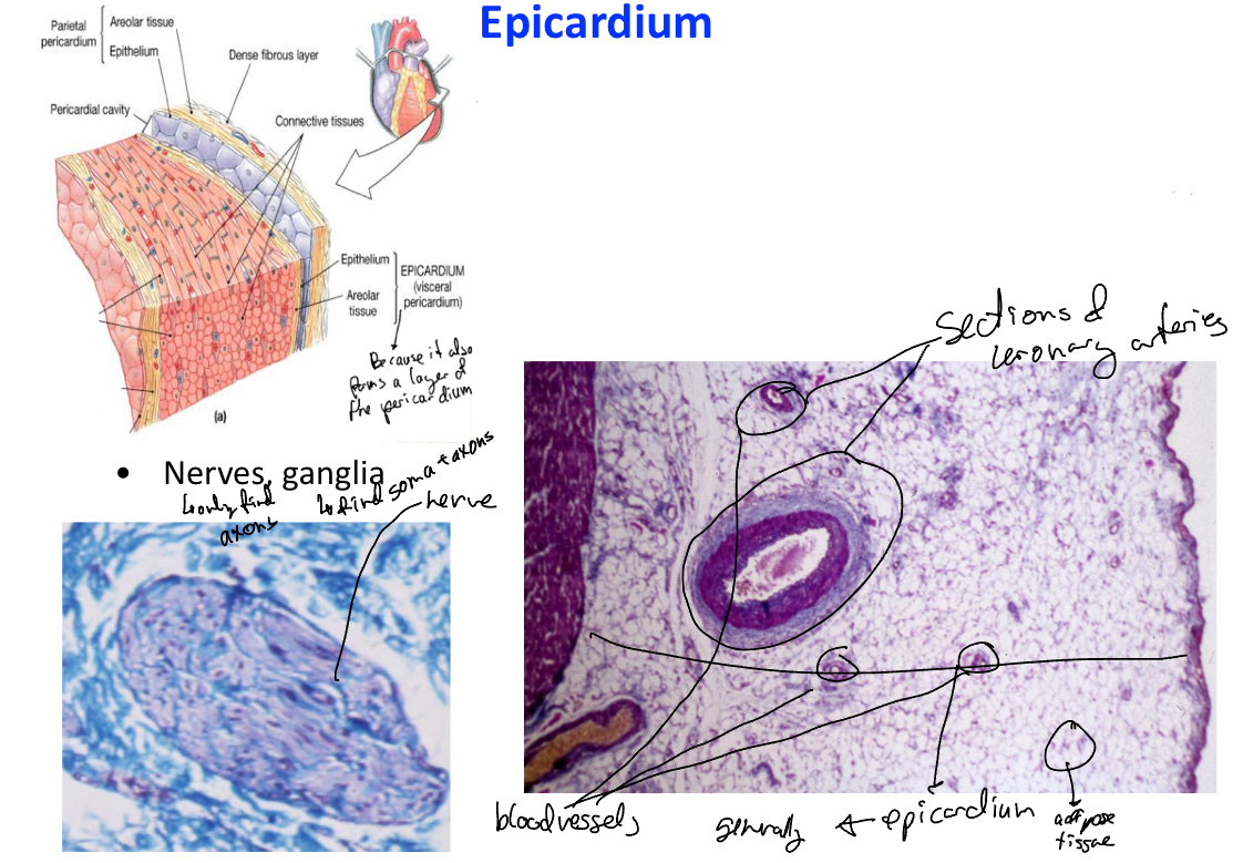 <p>Outermost layer of the heart (visceral layer of the pericardium). Has:</p><ul><li><p>mesothelium: simple squamous epithelium (external surface)</p></li><li><p>Submesothelial layer: FIrboblastic connective tissue with</p><ul><li><p>Adipocytes</p></li><li><p>Coronary vessels</p></li><li><p>Lymphatic vessels</p></li><li><p>Nerves/ganglia</p></li></ul></li></ul><p></p>