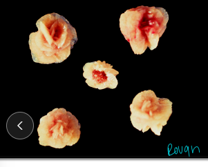 <p><span style="background-color: transparent;"><strong>Calcium Oxalate Uroliths</strong></span></p>