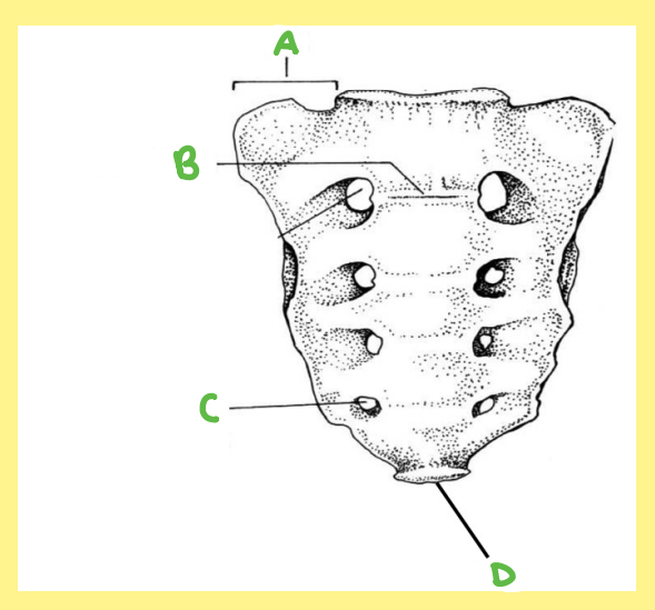 <p><u>Name the following</u>:</p><ul><li><p>Bone?</p></li><li><p>Side?</p></li><li><p>View?</p></li><li><p>Specific Surface? (if applicable)</p></li><li><p>A?</p></li></ul><p></p>