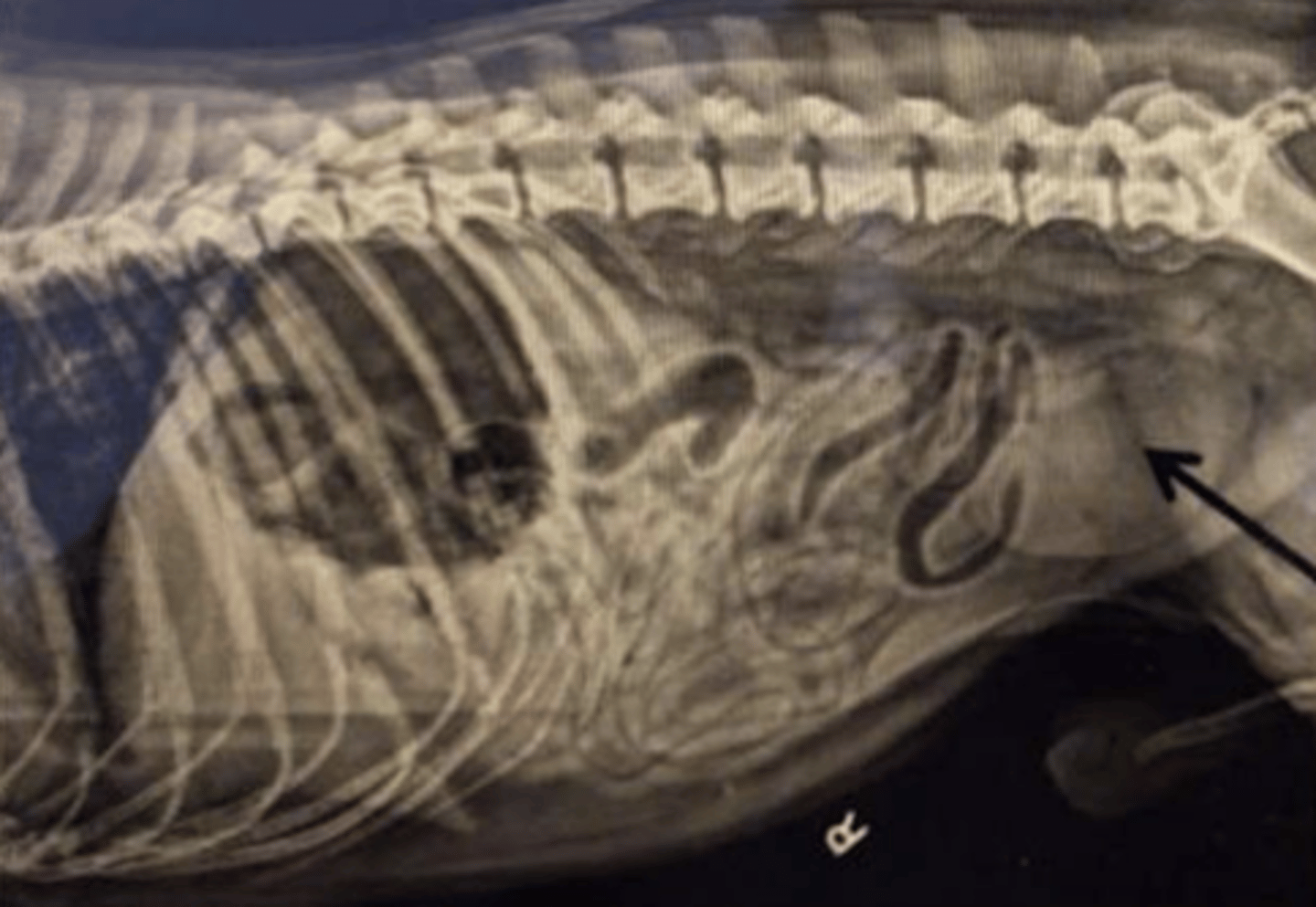 <p>What structure is the arrow pointing to?</p><p>a) Rectum</p><p>b) Bladder</p><p>c) Prostate gland</p><p>d) Uterus</p>