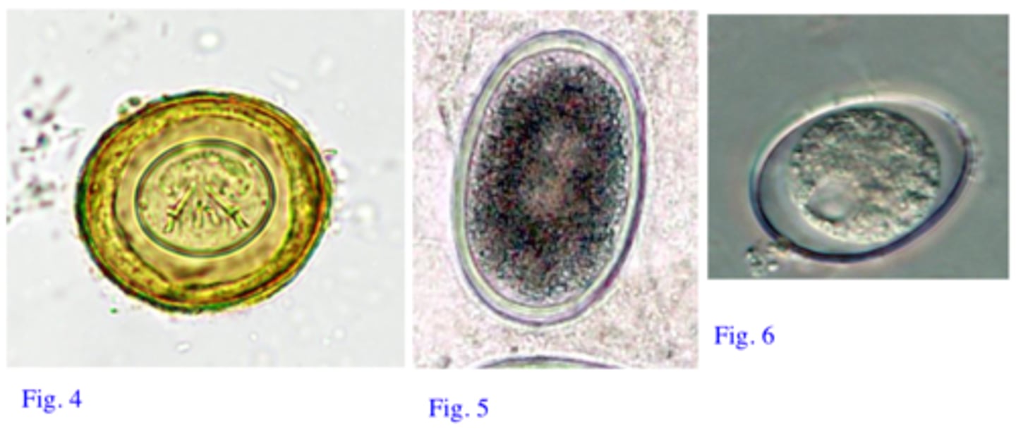 <p>Station 3:</p><p>Q3: Which of the eggs from the Fig 4-6 are likely to belong to this parasite? Identify the other twoeggs and describe their morphological features (Ascaridia galli)</p>