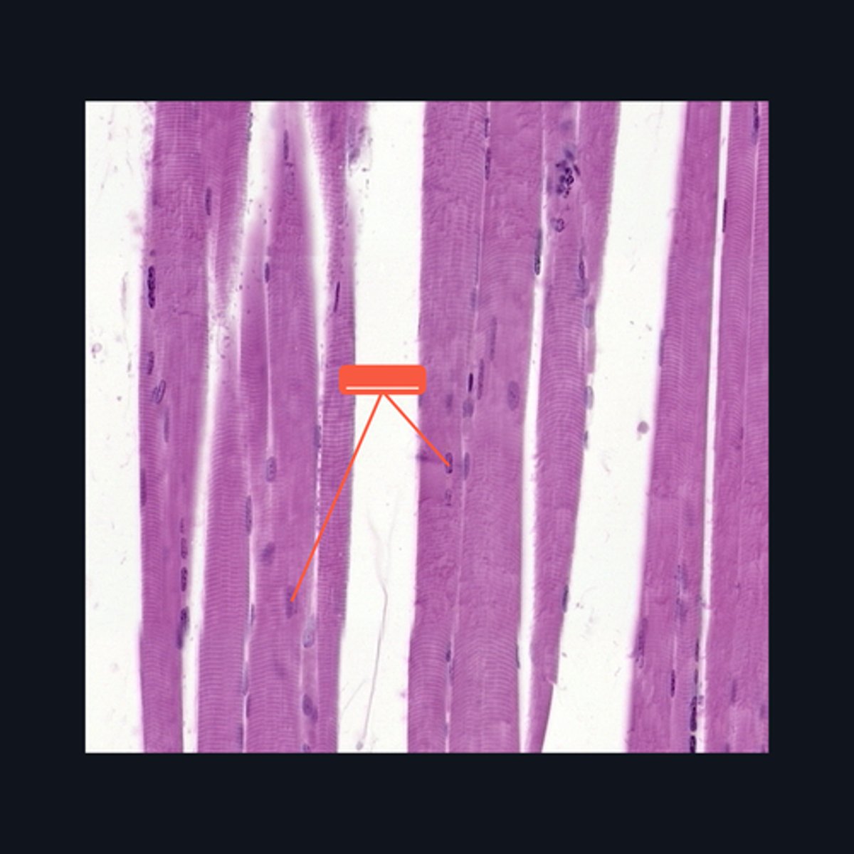 <p>Identify the structure</p>
