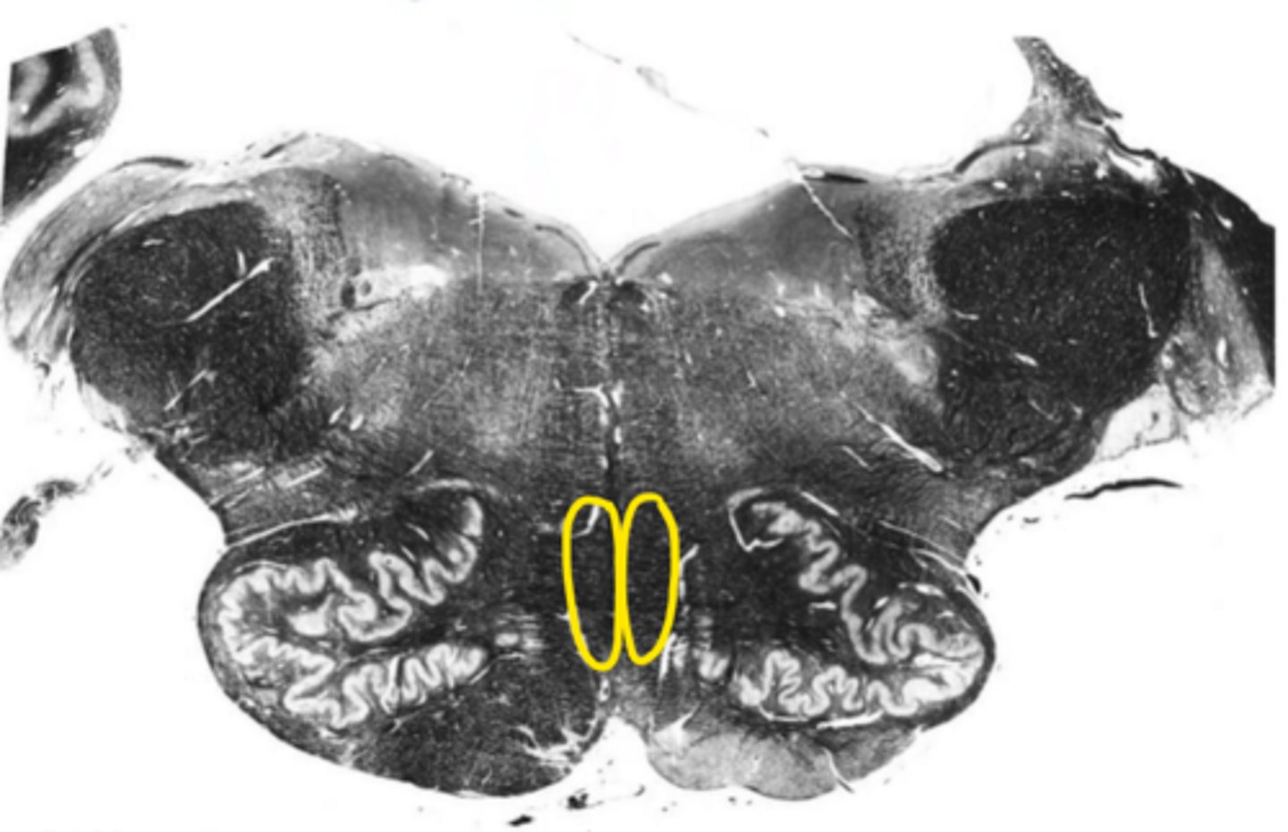 <p>ID the structure</p>