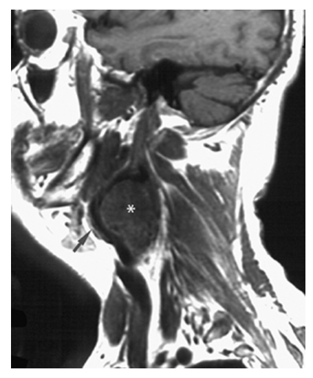 <p>What does the figure show?</p>