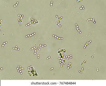 <p>wash urself or u will get: </p>