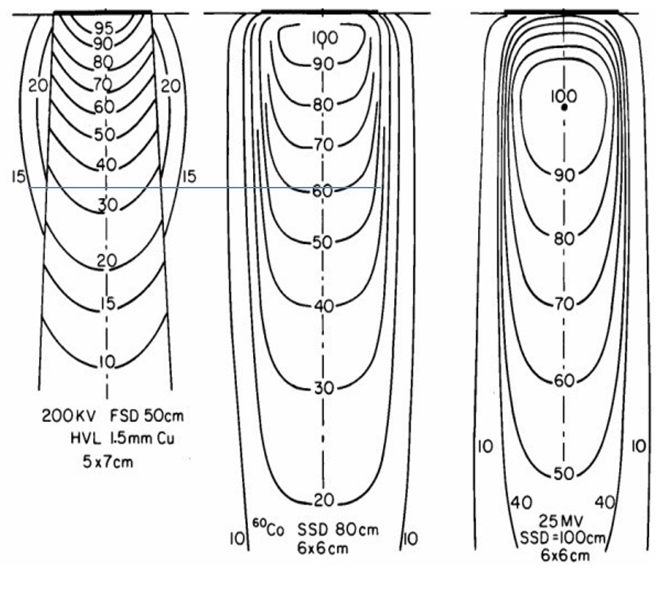 <p>dose was much better at depth</p><ul><li><p>200 kV: at 10  cm depth we got 35% of surface dose</p></li><li><p>Co<sup>60</sup>: at 10 cm depth, we got 55% of  surface dose</p><ul><li><p>compared to modern LINAC: 80%</p></li></ul></li></ul><p></p><p>radiation output was steady, easier to predict, and more controlled</p>