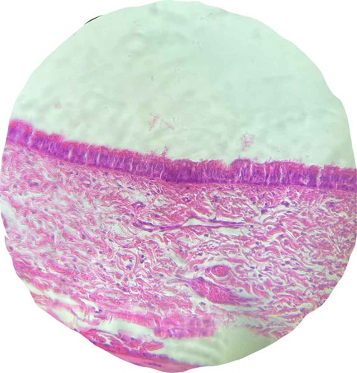 <p>what type of epithelial lining is found in this sample of the trachea?</p>