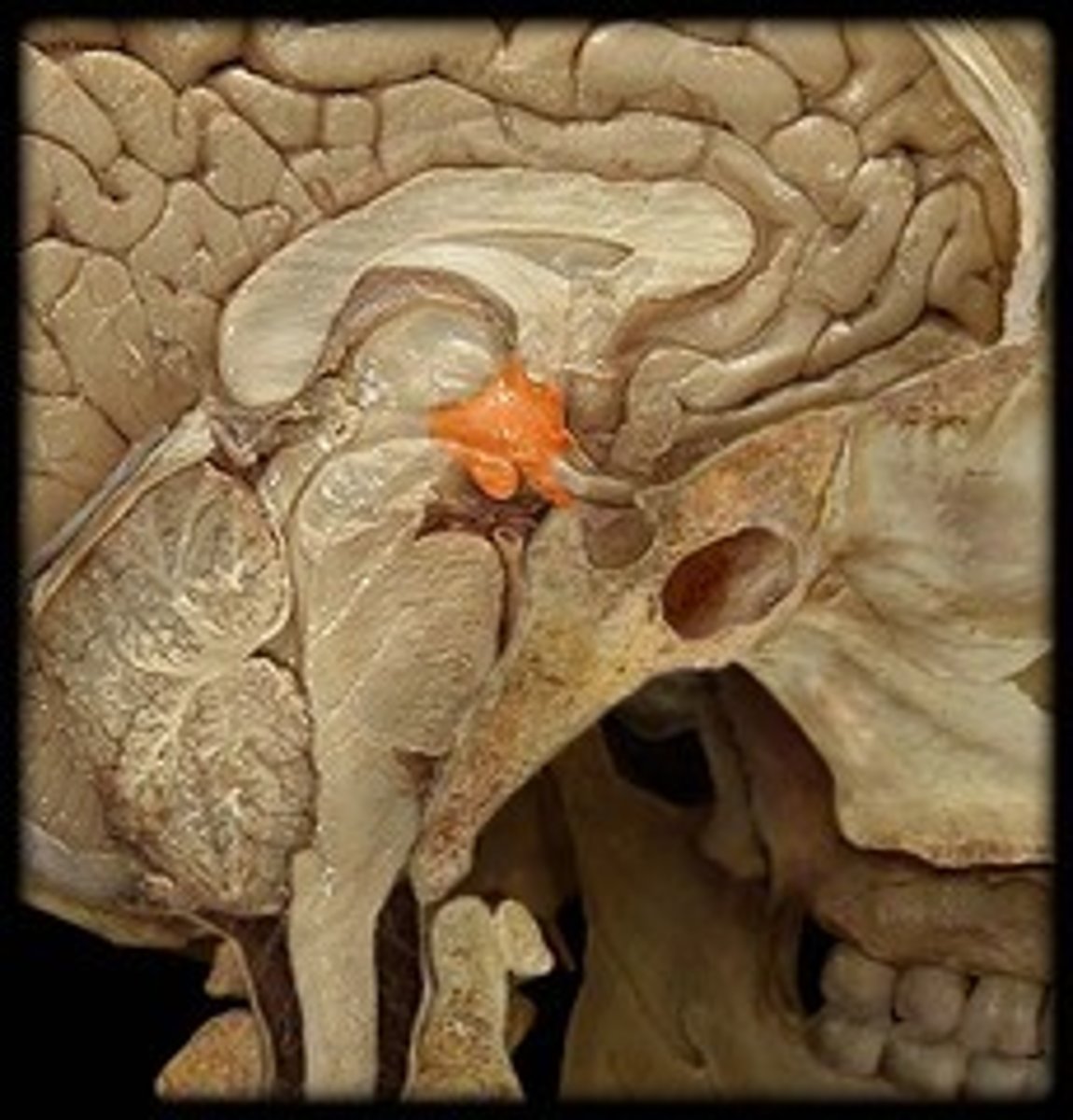 <p>(limbic system) regulates body temperature, sexual arousal, hunger, thirst, endocrine system 4 F's</p>