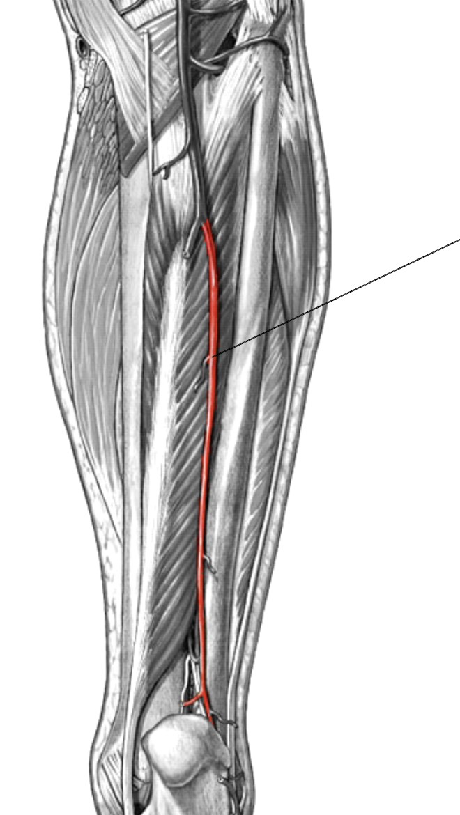 <p>Which arteries:</p><ul><li><p>Extends from posterior tibial artery</p></li><li><p>Inferior to posterior tibial artery</p></li><li><p>Posterior to fibula bone</p></li></ul><p></p>