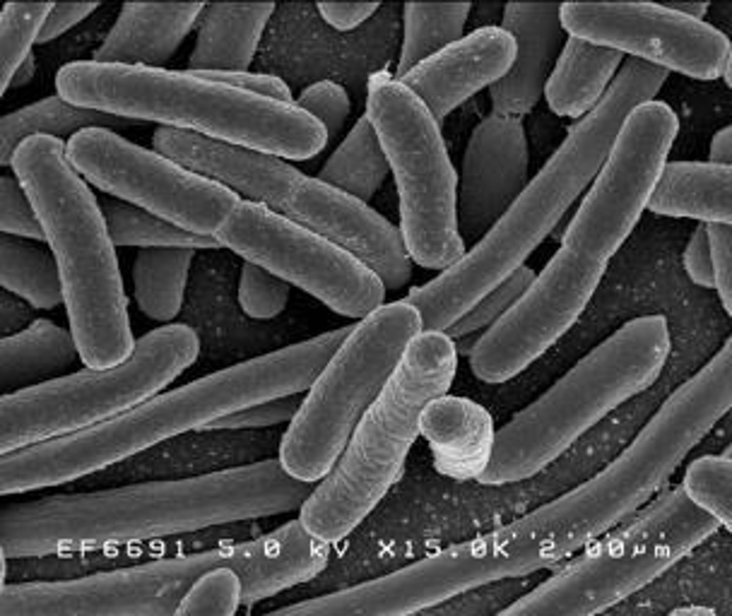 <p>Les cellules bactériennes sont unicellulaires et sans noyau, les cellules animales n'ont pas de paroi cellulaire et les cellules végétales ont une paroi cellulaire et des chloroplastes.</p>