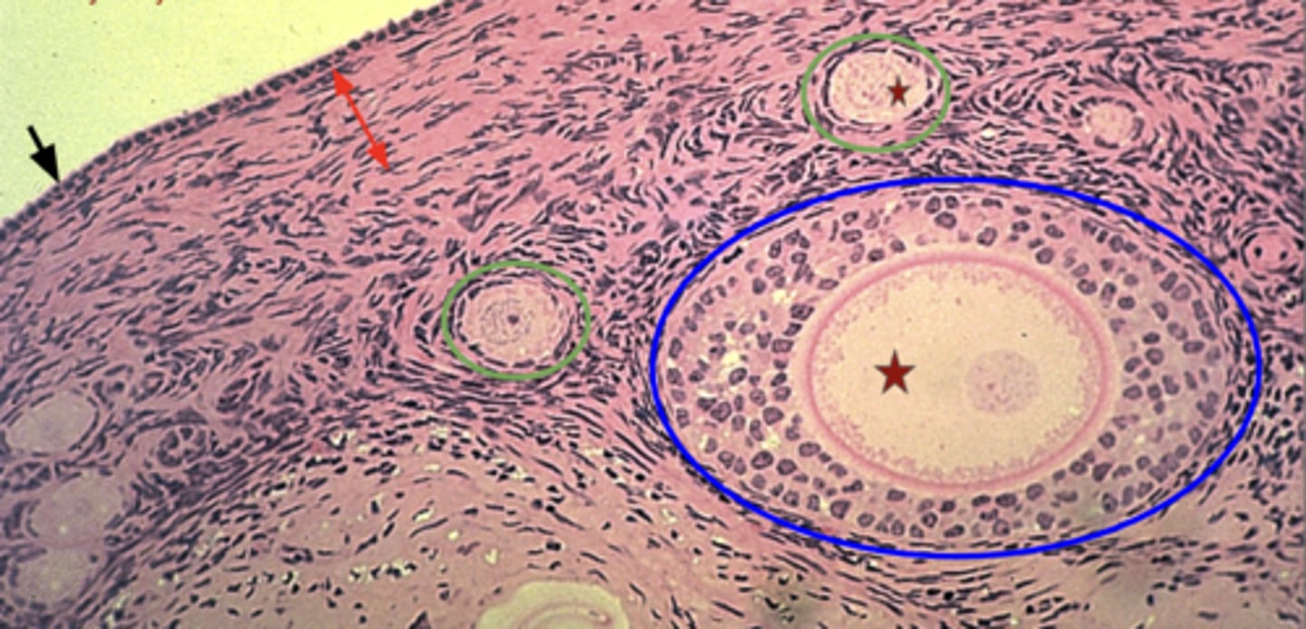 <p>What is the blue outline?</p>