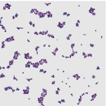 <p>what is the gram staining reaction of this organism?</p>