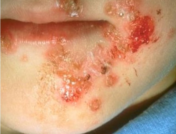 <p>What condition is this?</p>