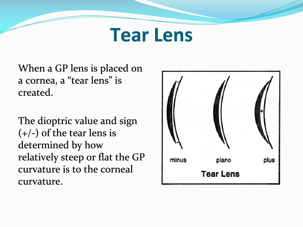 <p>When a GP lens is placed on the cornea, what is created?</p>