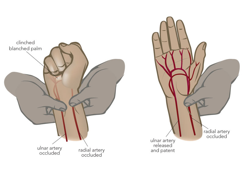 <p>ulnar test</p>