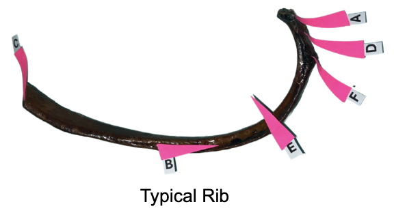 <p>Identify the neck</p>