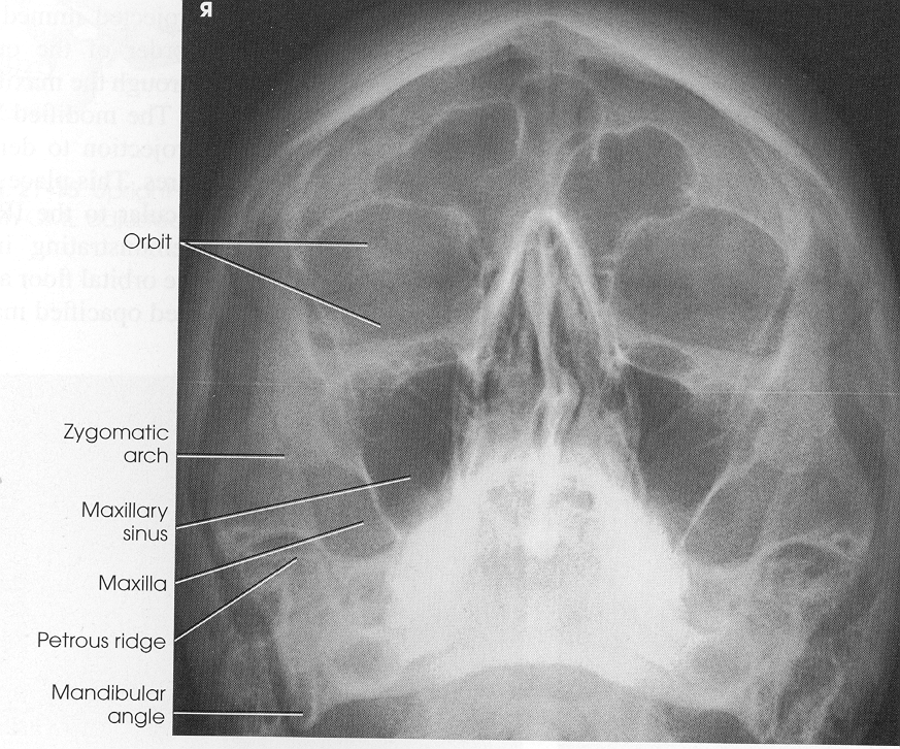 <p>xray</p>