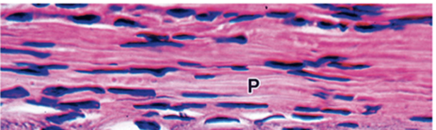 <p>Which types of cartilage lack a perichondrium? (3)</p>