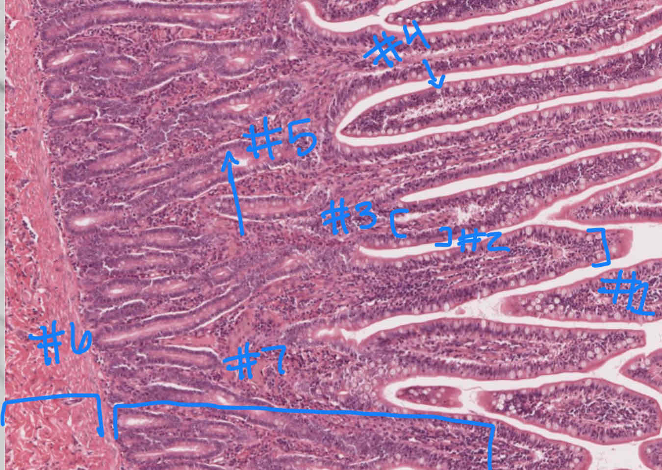 <p>What sublayer is indicated by #7?</p>