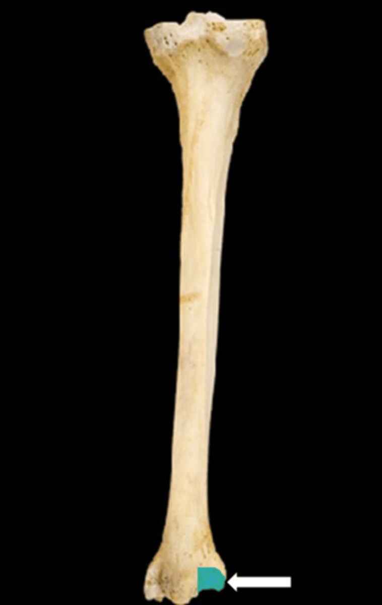 <p>name the part</p>