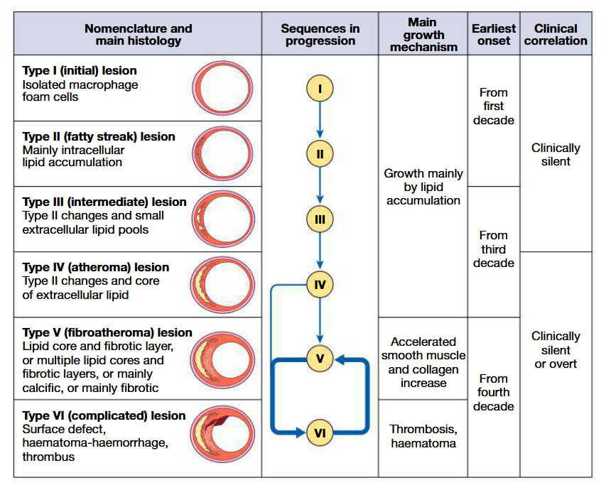 <ul><li><p>Cause in most patients: atherosclerosis</p></li><li><p>Other causes: aortitis, vasculitis and autoimmune connective tissue diseases</p></li><li><p>Atherosclerosis:<br>Progressive, inflammatory disorder of arterial wall</p></li><li><p>Characterised by focal lipid rich deposits of atheroma that remain clinically silent until they become large enough to impair tissue perfusion/until ulceration and disruption of lesion results in thrombotic occluslion</p></li><li><p>Begins early in life, with lipid depositing at sites of altered arterial shear stress (eg: bifurcations). Associated with abnormal endothelial function at said site</p></li><li><p>High risk: cigarette smokers and familial hyperlipidaemia and hypertension</p></li><li><p>During evolution of this plaque, monocytes and other inflammatory cells bind to receptors expressed by endothelium</p></li><li><p>These cells migrate into intima and pick up oxidised LDL particles by phagocytosis to become foam cells</p></li><li><p>Extracellular lipid pools appear in the intimal space where foam cells die and release their contents</p></li><li><p>In response to cytokines, smooth muscle cells migrate from media into intima and change from contractile to fibroblastic phenotype: stabilises plaque by covering lipid core with smooth muscle cells and matrix</p></li><li><p>If inflammation predominates: plaque becomes active or unstable and may be complicated by ulceration and thrombosis (due to release of cytokines by macrophages)</p></li><li><p>Exposure of plaque content to blood will trigger platelet response</p></li><li><p>May induce +ve or -ve remodelling</p></li></ul><p></p>