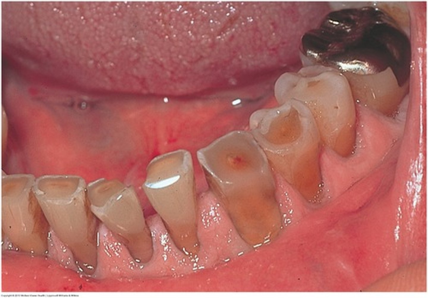 knowt flashcard image