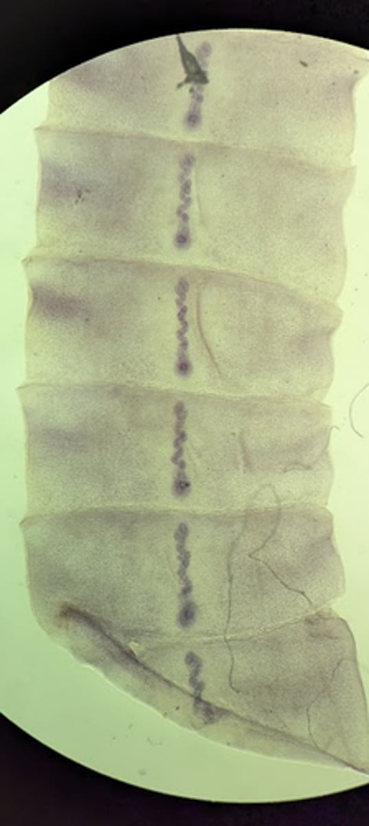 <p>Rosette uterus in the middle of each</p>