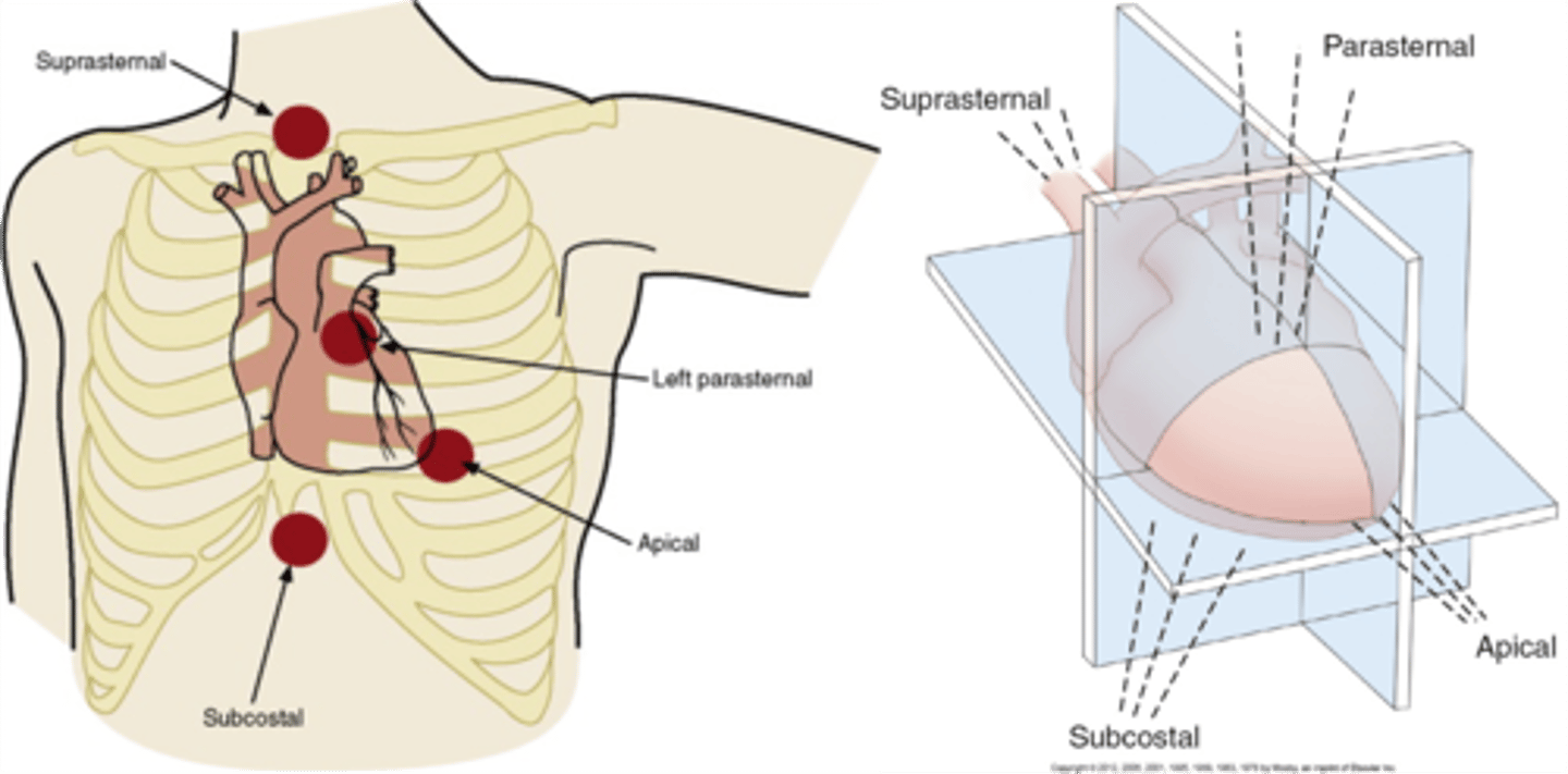 <p>1. suprasternal</p><p>2. subcostal</p><p>3. apical</p><p>4. parasternal</p>