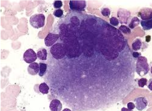 <p>is this an early or late megakaryocyte?</p>