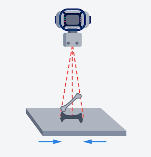 Which type of shape distortion is represented in the following illustration?