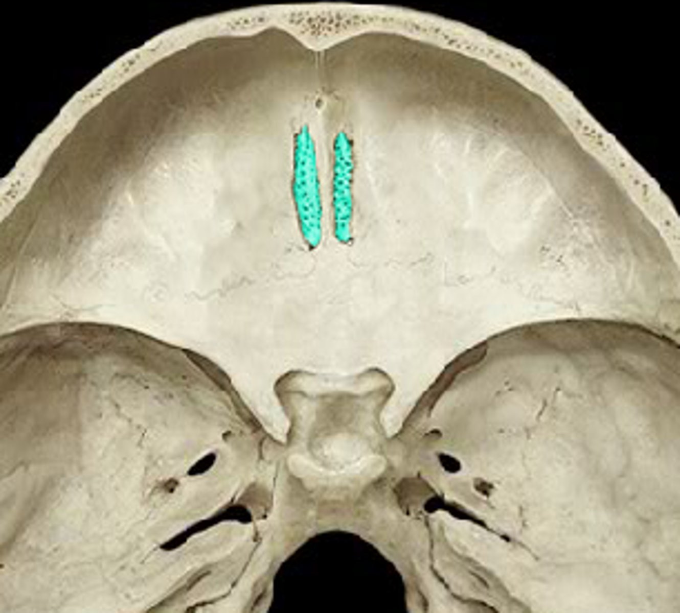 <p>Transmits Olfactory nerves</p>