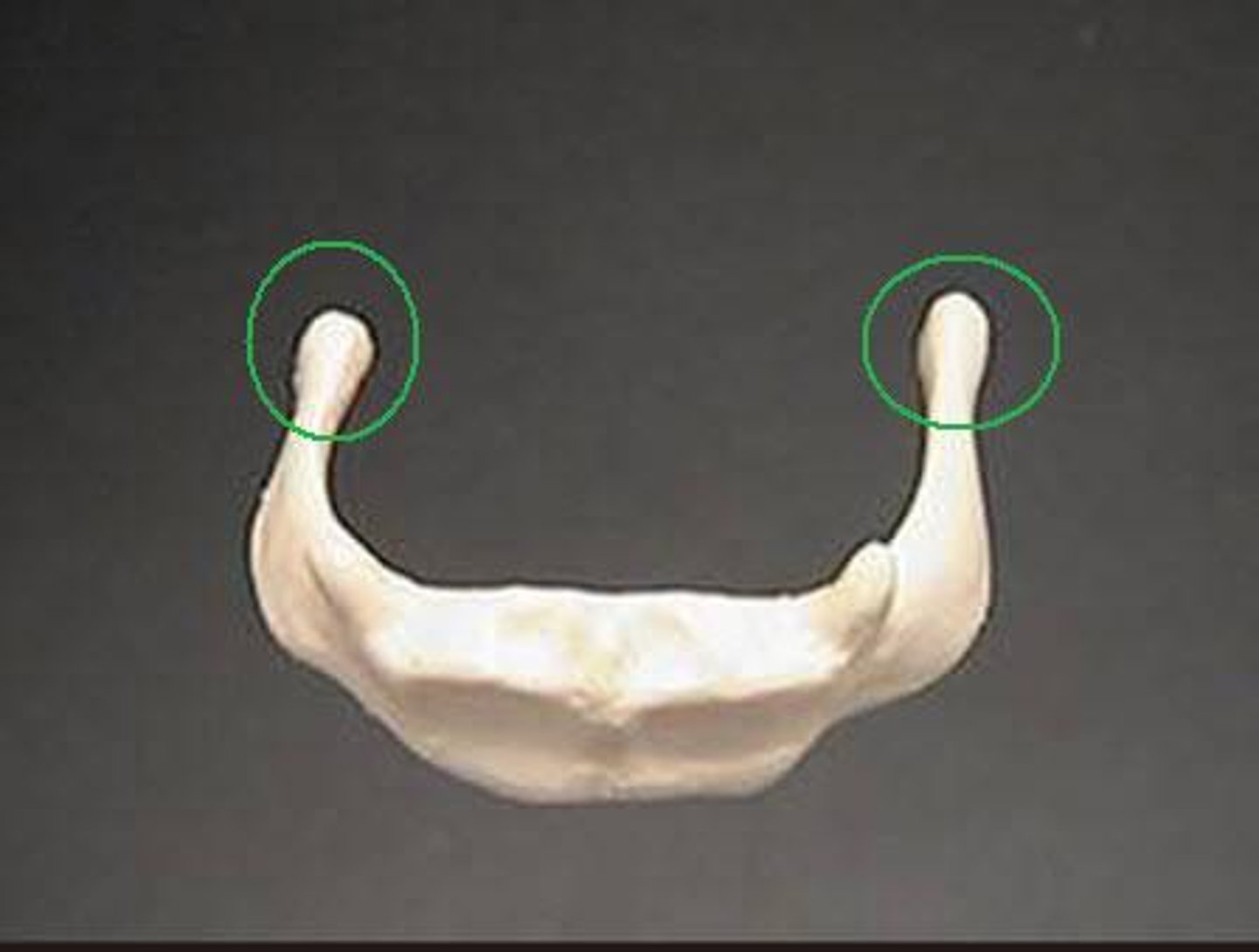 <p>the larger, posterior projection from the body of the hyoid bone</p>