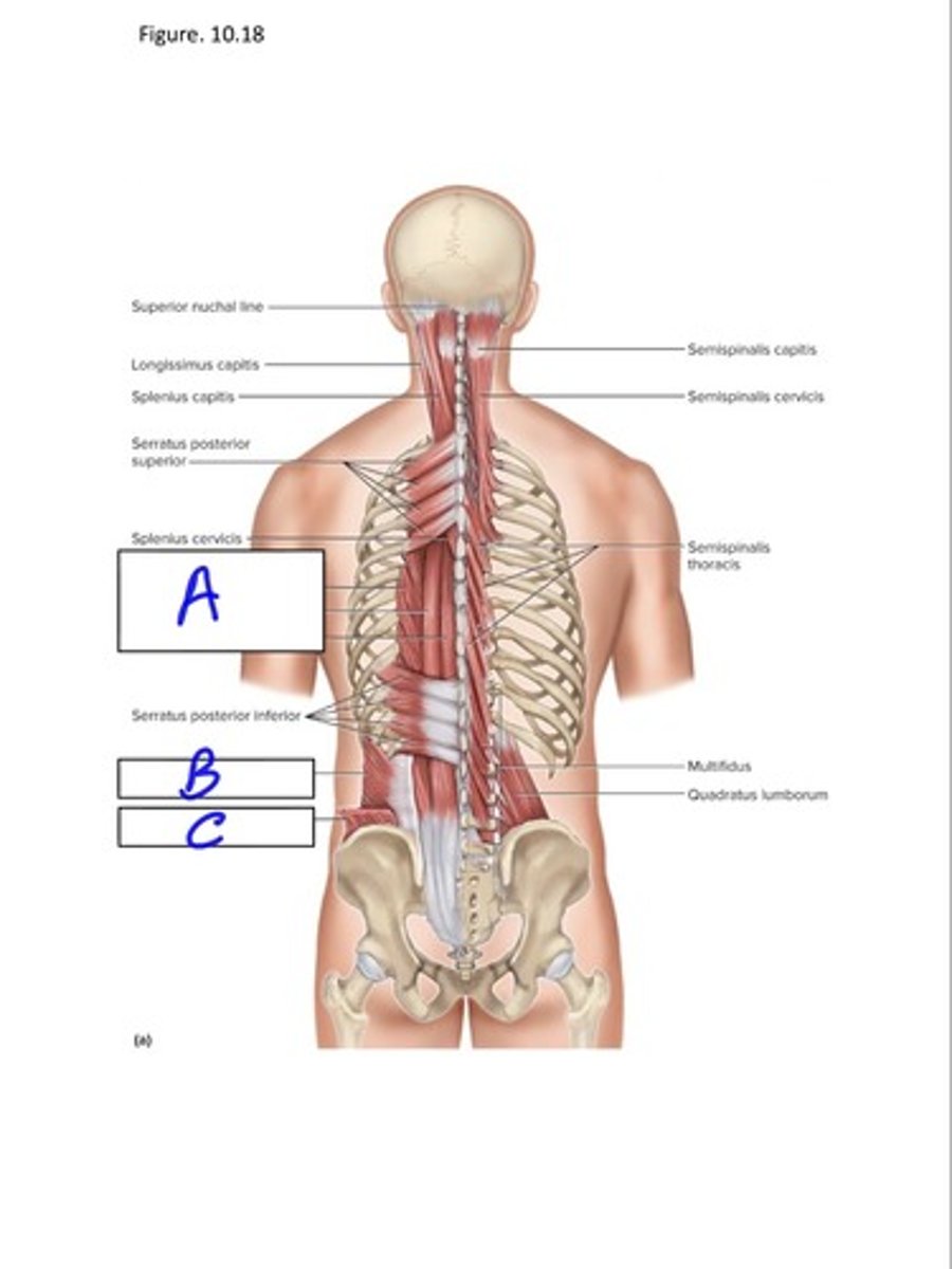 <p>B</p>