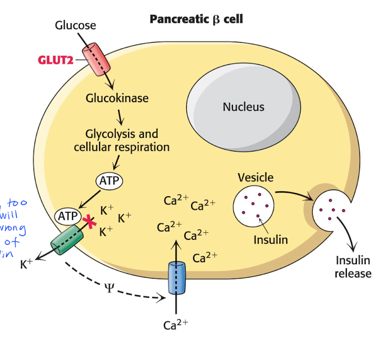 <p>Insulin released by pancreas is regulated by the blood glucose conc (with ATP and ion channels)</p><ul><li><p>High [glucose] e.g high lipid levels stimulates insulin synthesis and secretion ( high ATP = changes potential = insulin release)</p></li><li><p>The insulin are produced as <strong>pre-insulin</strong>, too much of those causes <strong>ER stress</strong> because the body can’t process that much insulin at the same time. ER tries to produce even more insulin. </p></li><li><p>Too much insulin —&gt; increased missfolding of proteins —&gt; incresed chaperones —&gt; increased breakdown of wrong proteins.</p></li><li><p>Unfolded proteins —&gt; <strong>UPR </strong>If ER stress can’t be fixed, them <strong>optosis (programmed cell death) </strong>will occur. </p></li></ul><p></p>