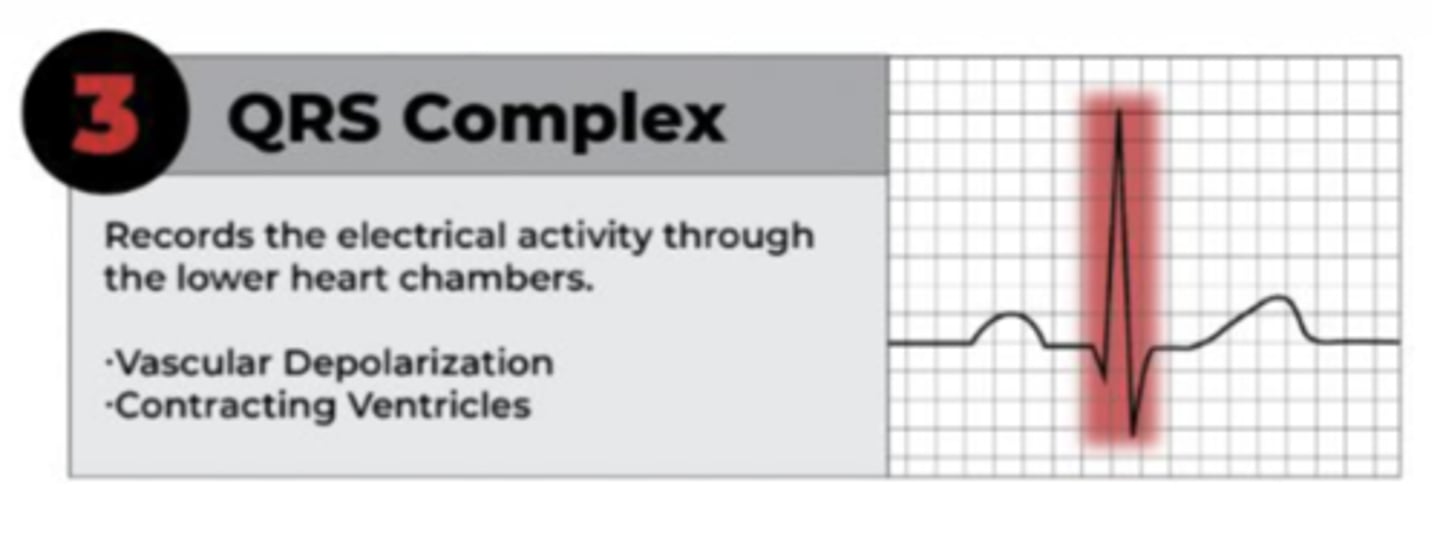 <p>• Lower heart chambers</p><p>• Ventricular depolarization (or ventricular systole (contraction))</p><p>• Q wave: first downstroke</p><p>• R Wave: first upward spike</p><p>• S Wave: downward dip</p>