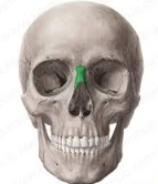 <p>What bone of the skull is this?</p>