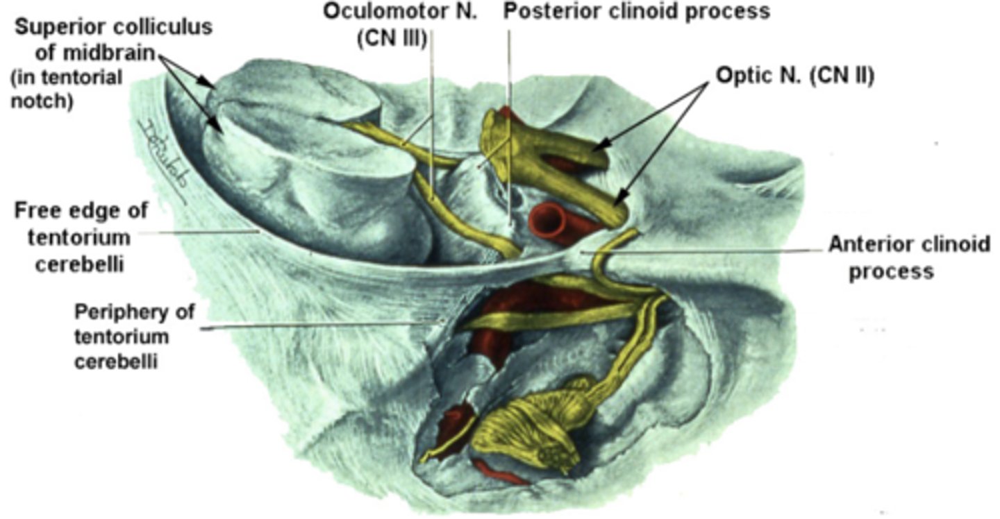 <p>Which cranial nerve runs between the attachment sites of the tentorium cerebelli with the anterior and posterior clinoid processes?</p><p>**potential site of injury for this nerve</p>