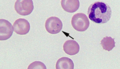 <p><span style="color: rgb(255, 255, 255);"><span>INTRAcellular - tiny basophilic, pear-shaped inclusions in RBCs; occurs in pairs that form an acute angle within the RBC</span></span></p>
