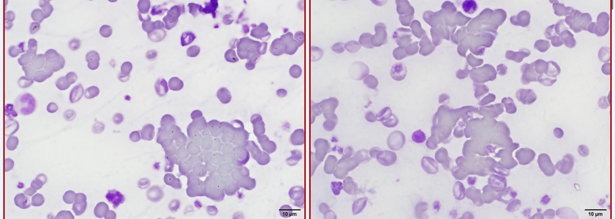 <p>What RBC morphology abnormality is depicted?</p>