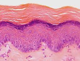 <p>stratified squamous keratinized ET </p>