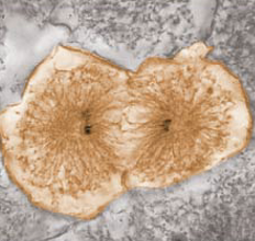 <p>What stage of mitosis is this cell in</p>