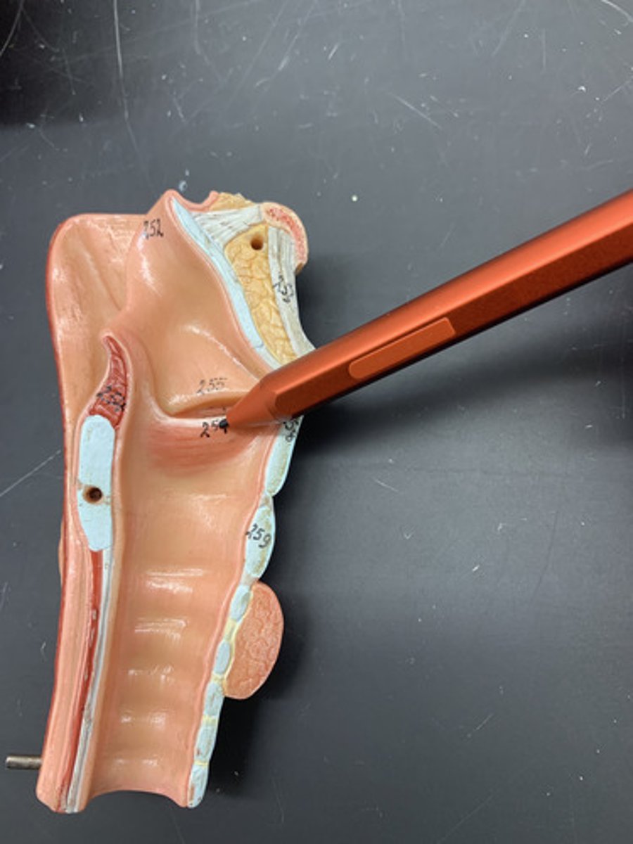 <p>Mucosal folds that function in voice production (speech); also called the true vocal cords.</p>