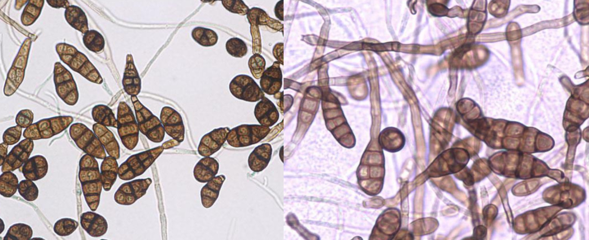 <p>Alternaria sp. - zarodniki konidialne</p>