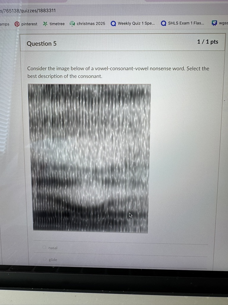 <p>Consider the image below of a vowel-consonant-vowel nonsense word. Select the best description of the consonant.</p>