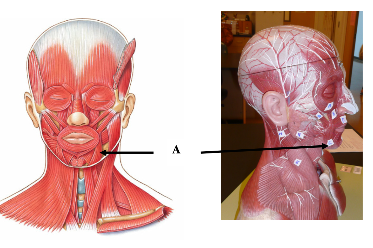 <p>What muscle is arrow A pointing to?</p><p></p><p>A. risorius</p><p>B. orbicularis oculi</p><p>C. zygomaticus</p><p>D. depressor anguli oris</p>