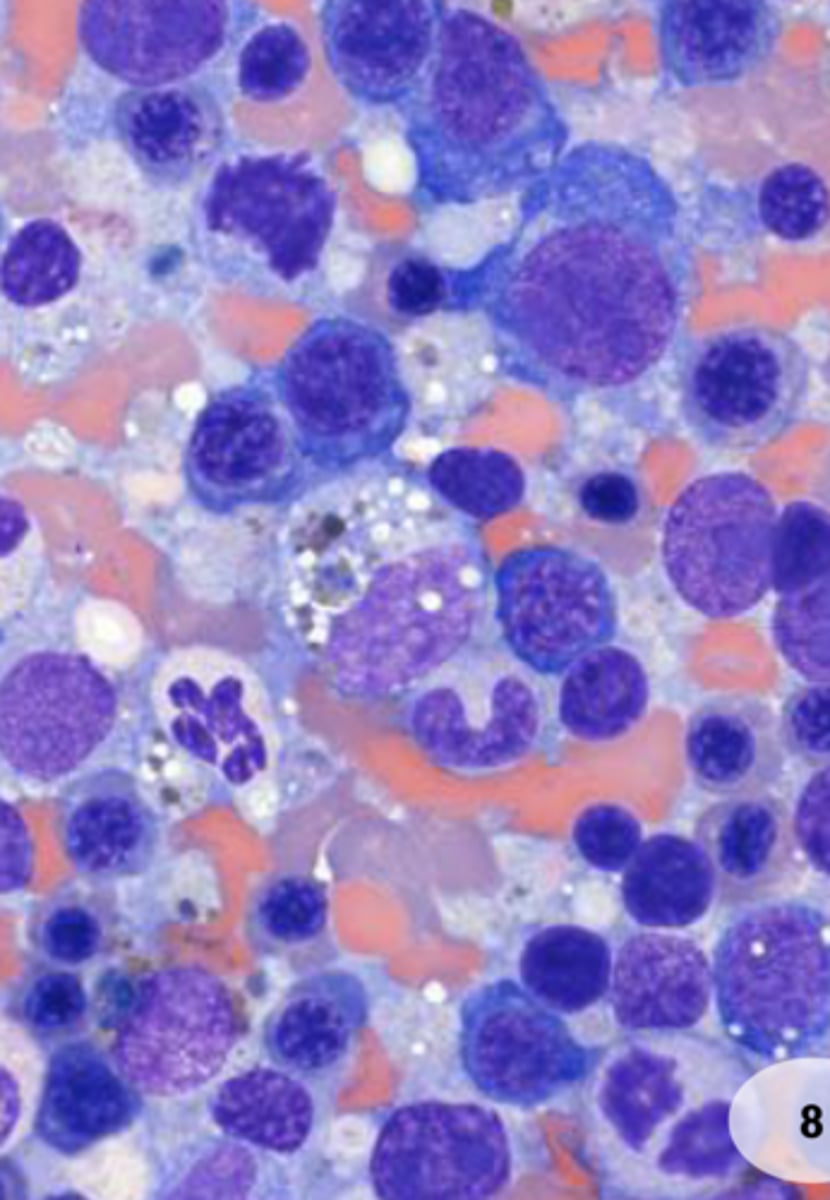 <p>- Precursor Immune-Mediated Anemia (PIMA)</p>