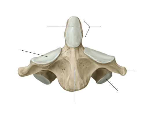 <p>Name this special cervical vertebrae and its defining factor</p>