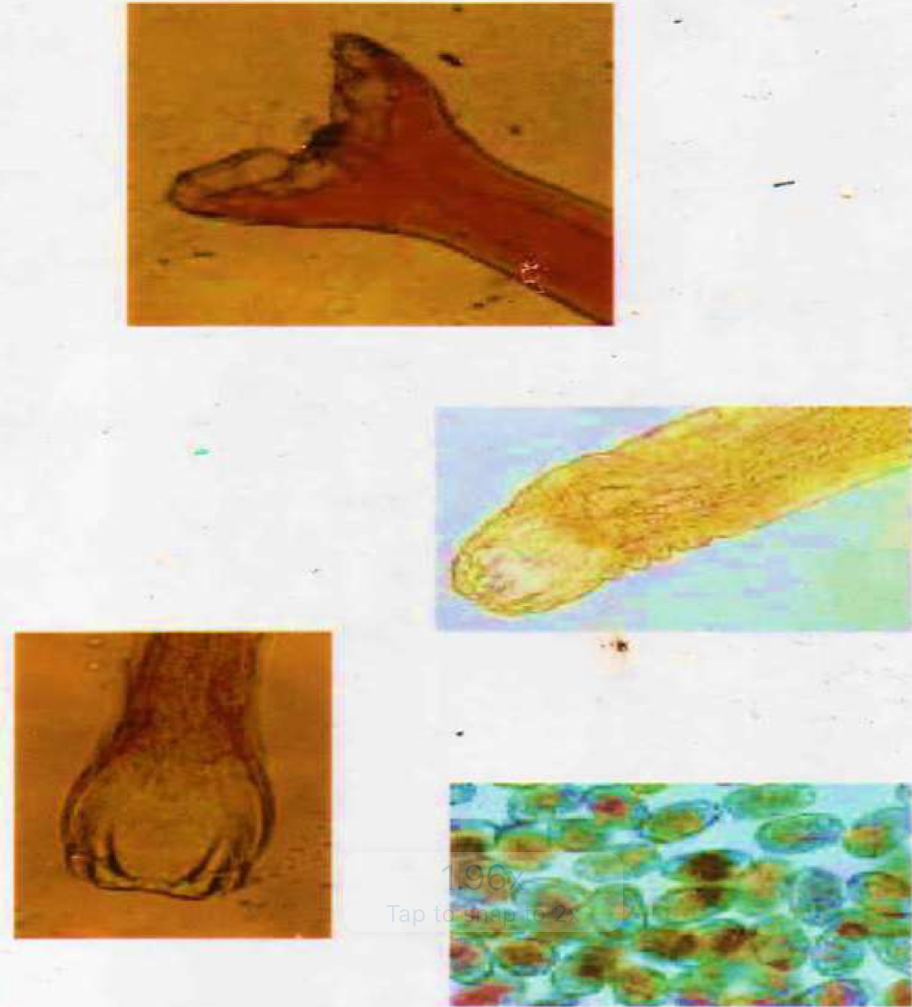 <p>Parasite under microscope?</p>