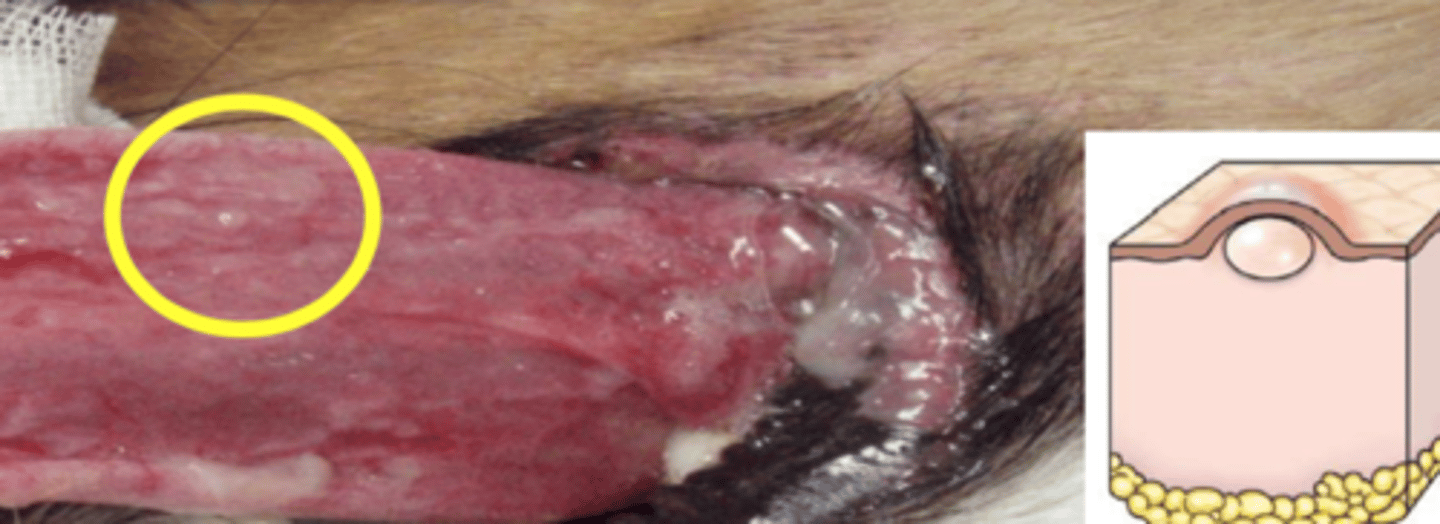 <p>What lesion is this? Is it primary or secondary?</p>