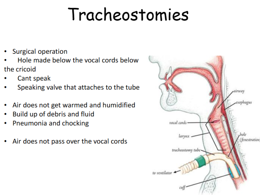 <p><span>Surgical operationto create an opening in the trachea to facilitate breathing. </span></p>